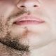 عوامل مؤثر در کم پشتی موی ریش و سبیل