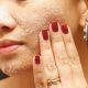 آموزش ماسک و اسکراب خانگی برای لایه برداری پوست